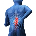 Botox For Back Pain Relief